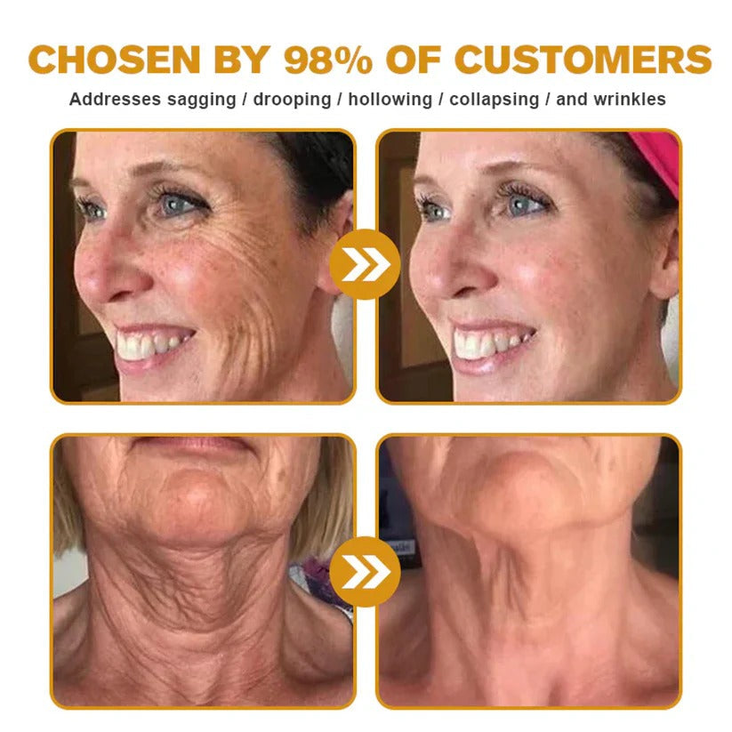 đ„FDA Approved: Bee Venom Skin Restoration Cream â đ„Limited Time 80% OFFđ„